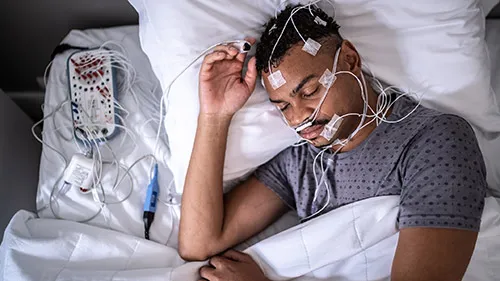 A man undergoing a sleep study, with electrodes attached to his head and body, lying in bed and connected to monitoring equipment.